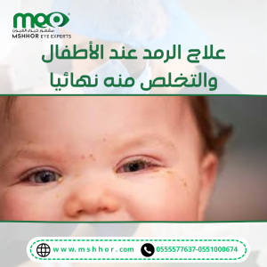 الرمد عند الاطفال | دليل شامل من مركز د/محمد مشهور
