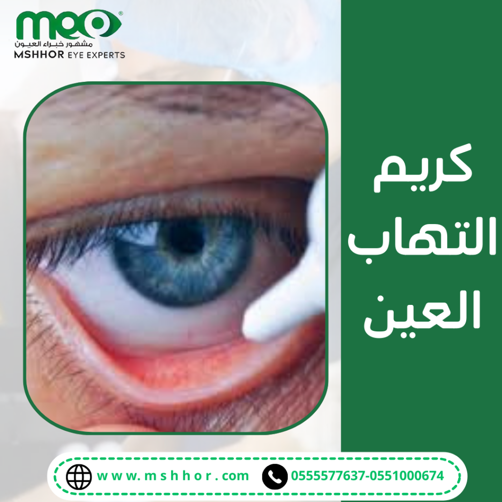 طرق استخدام كريم التهاب العين والجرعات الموصي بها