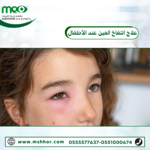 انتفاخ تحت العين للاطفال: الأسباب الشائعة وطرق العلاج الآمن