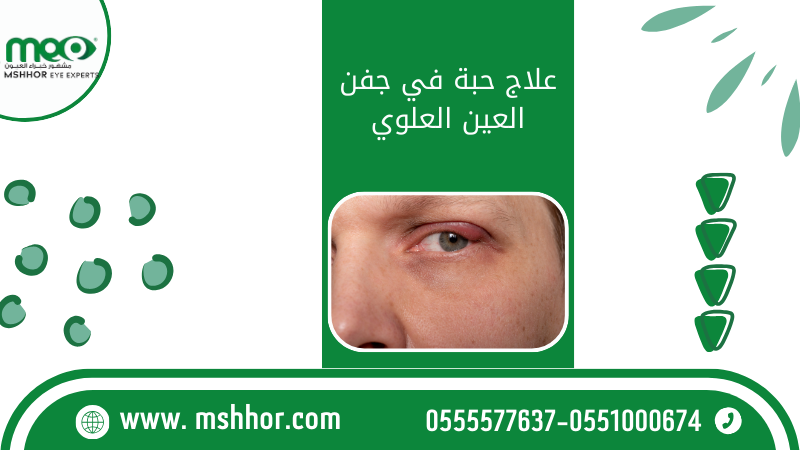 علاج حبة في جفن العين العلوي