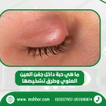حبة داخل جفن العين العلوي