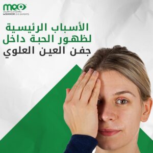 الأسباب الرئيسية لظهور الحبة داخل جفن العين العلوي