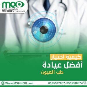 كيفية اختيار أفضل عيادة طب العيون