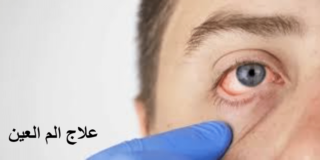 علاج الم العين