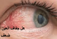 هل جفاف العين يسبب ضعف النظر