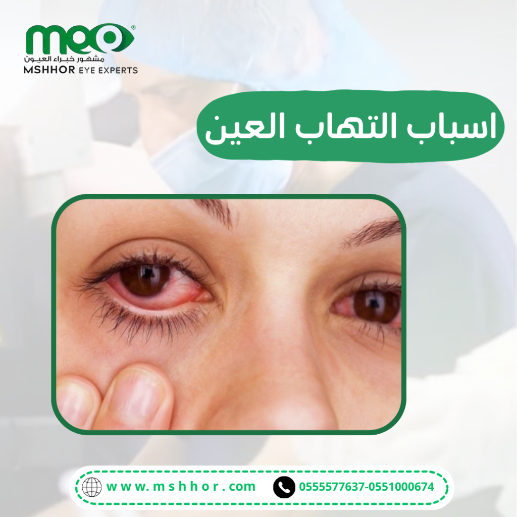 تعريف اسباب التهاب العين 