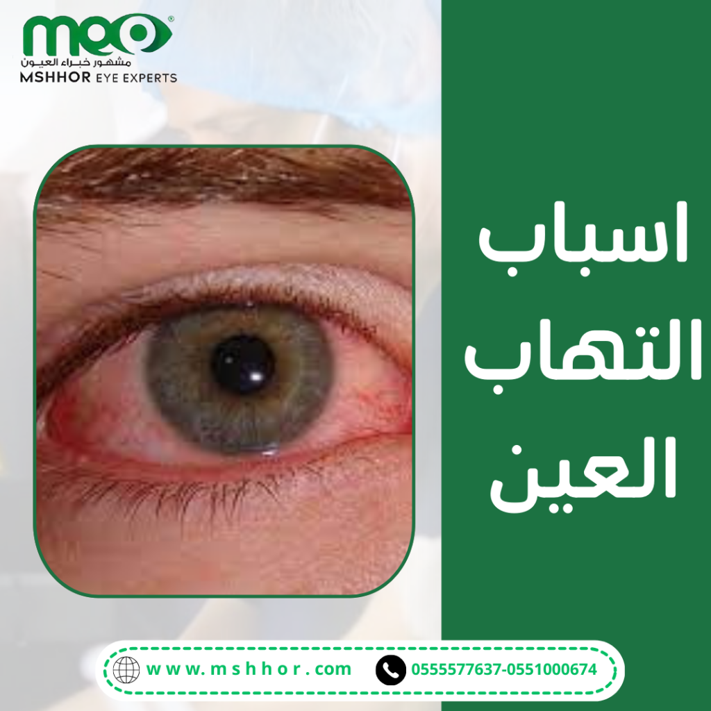 كيفية تشخيص اسباب التهاب العين