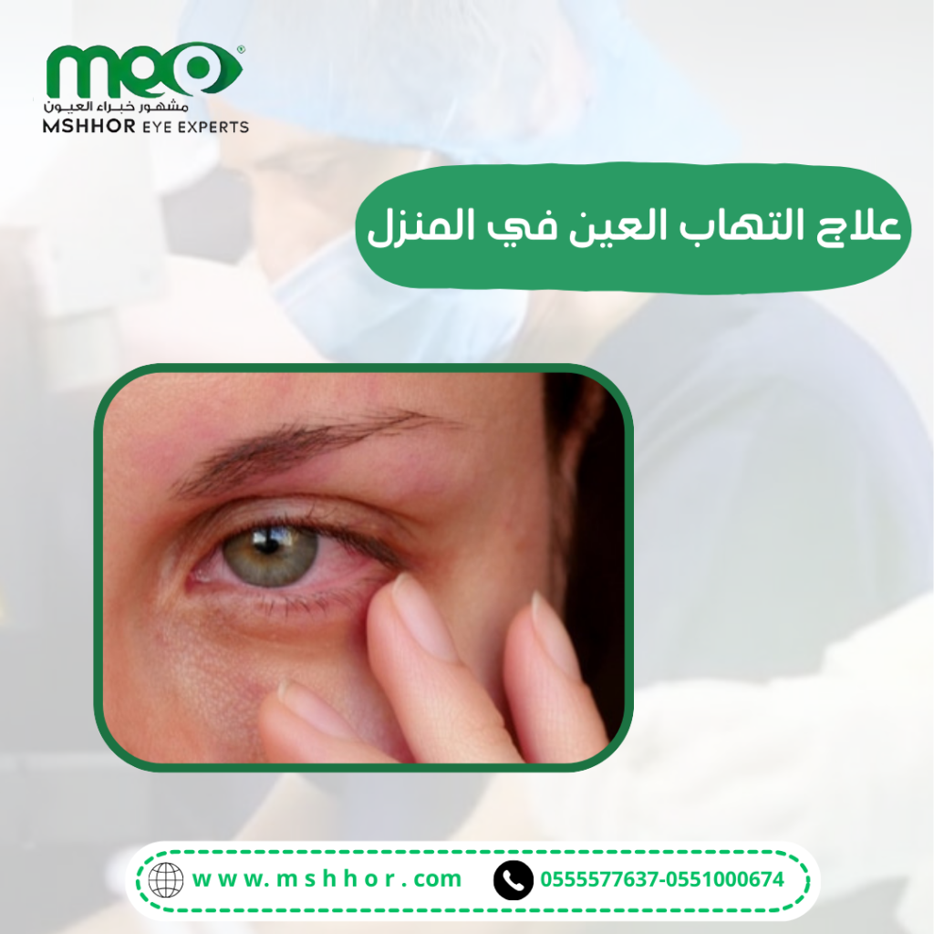 تعريف علاج التهاب العين في المنزل 