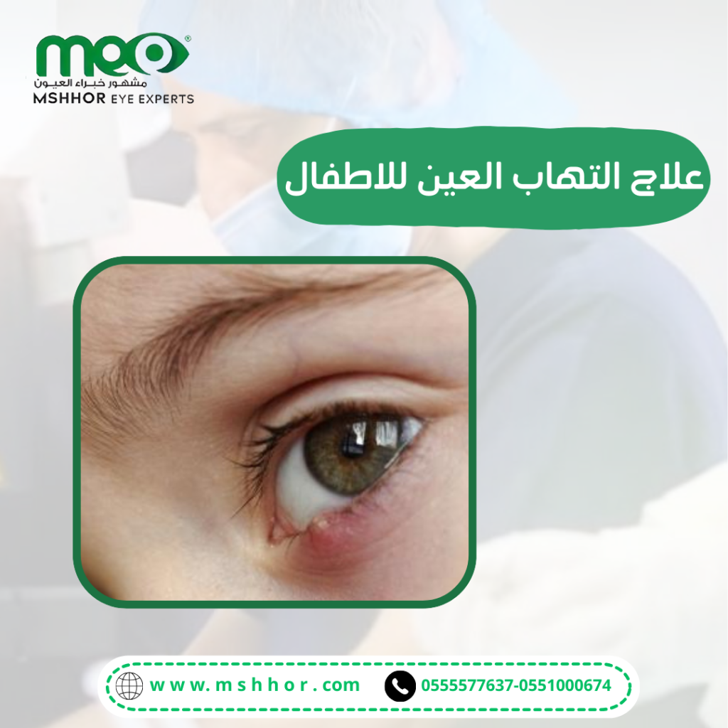 علاج التهاب العين للاطفال 