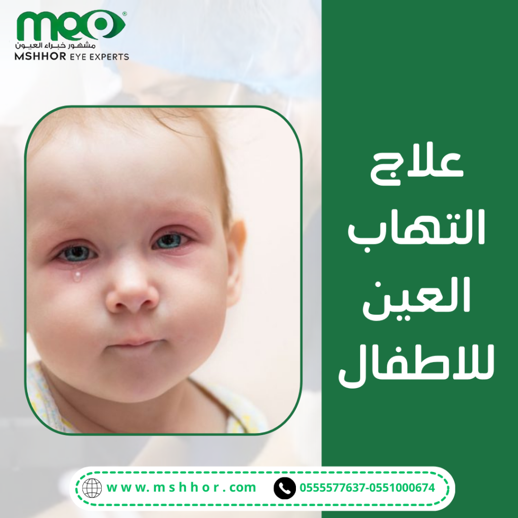 علاج التهاب العين للاطفال الدوائي
