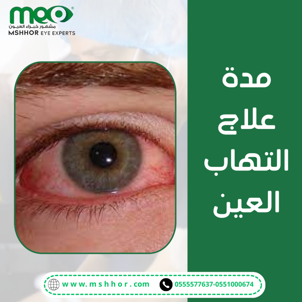 طرق علاج التهاب العين