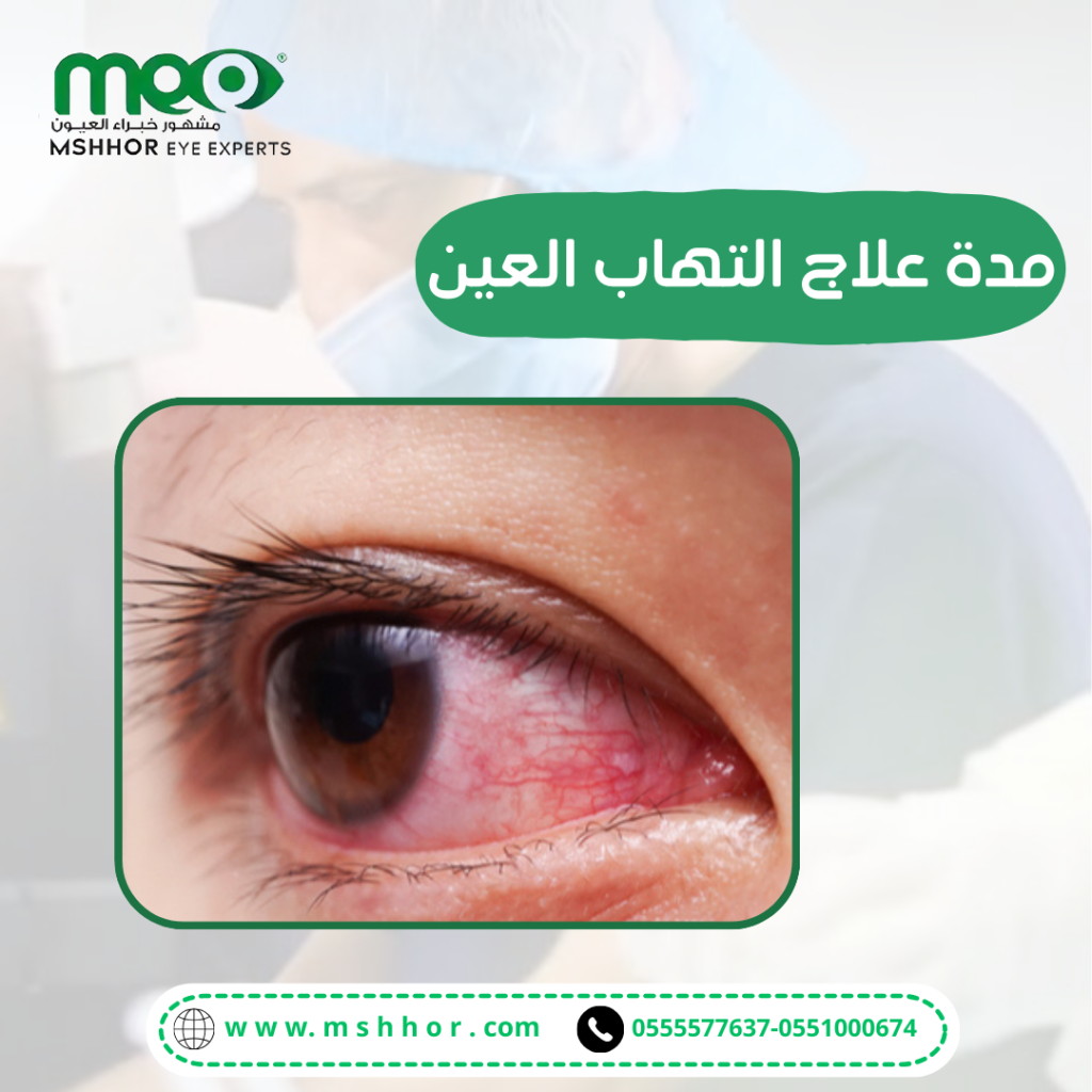 مدة علاج التهاب العين 