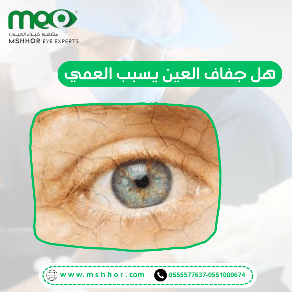 هل جفاف العين يسبب العمي