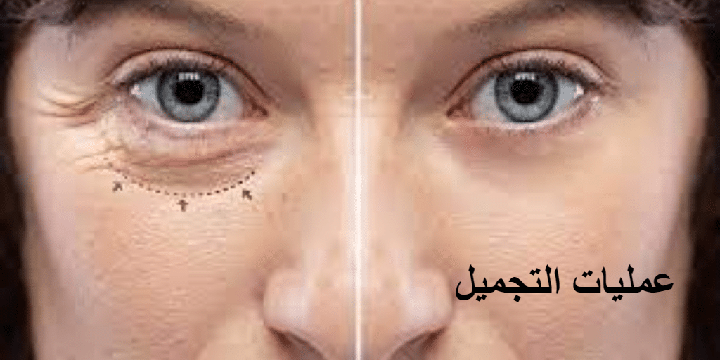 المخاطر والاعتبارات الطبية لعمليات التجميل للعيون