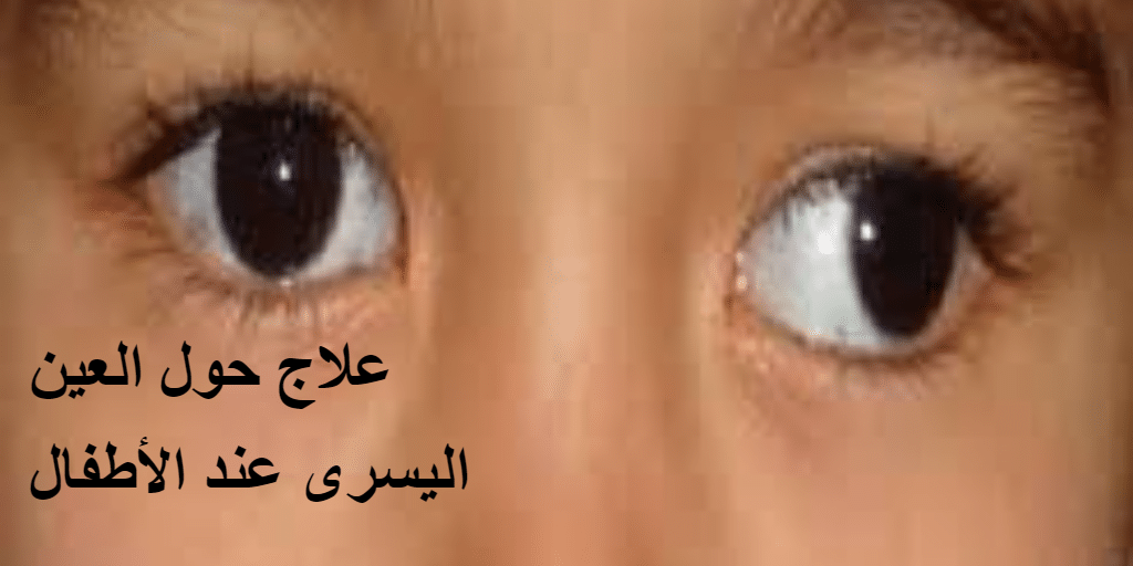 أعراض حول العين اليسرى عند الأطفال