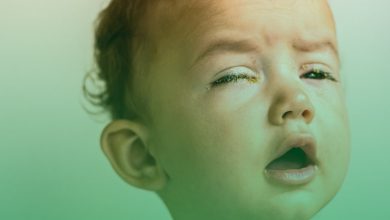 أسباب افرازات العين عند الاطفال وكيفية علاجه