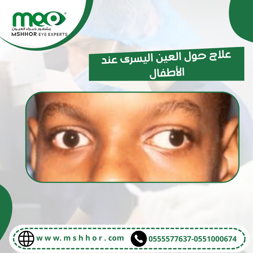 علاج حول العين اليسرى عند الأطفال