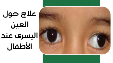 علاج حول العين اليسرى عند الأطفال