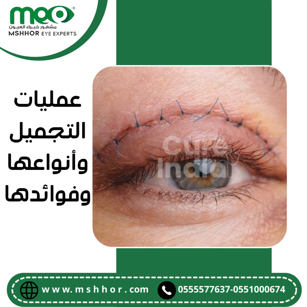 عمليات التجميل وأنواعها وفوائدها