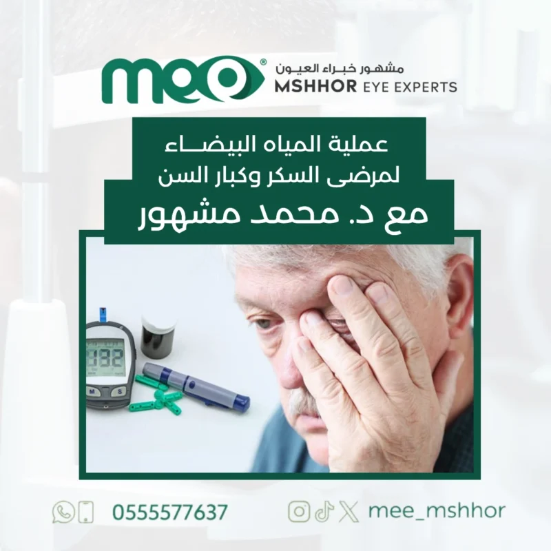 عملية المياه البيضاء لمرضى السكر وكبار ال