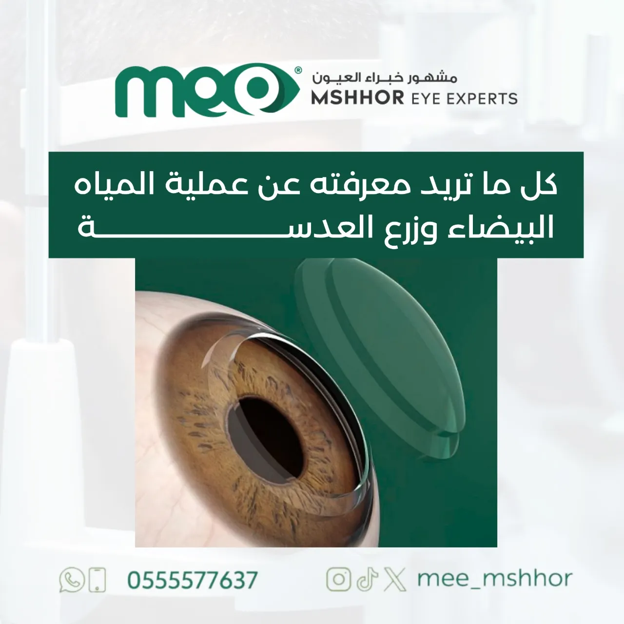 عملية المياه البيضاء وزرع العدسة