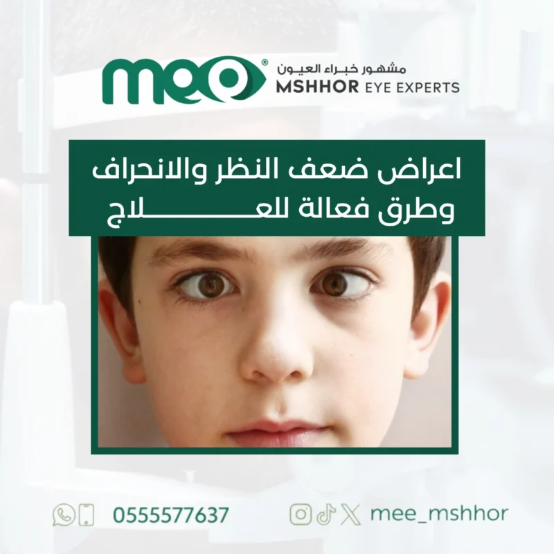 اعراض ضعف النظر والانحراف