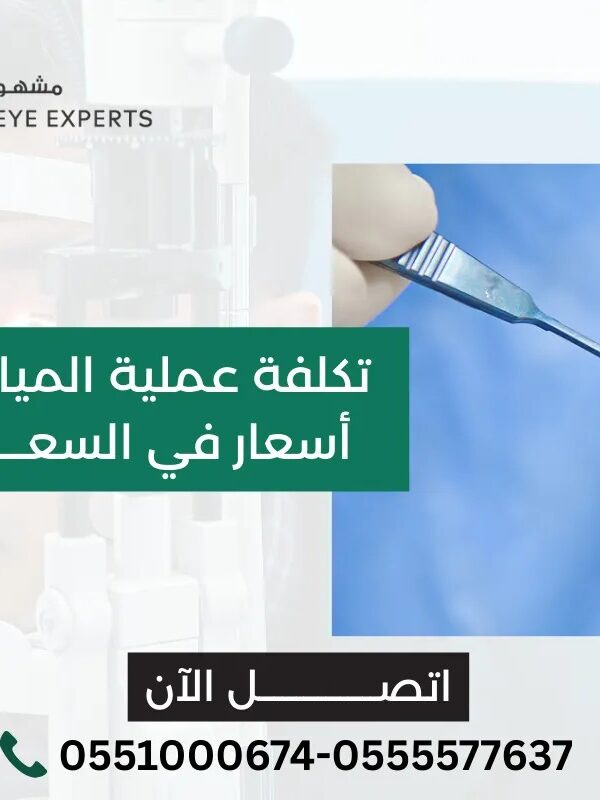 تكلفة عملية المياه البيضاء في العين
