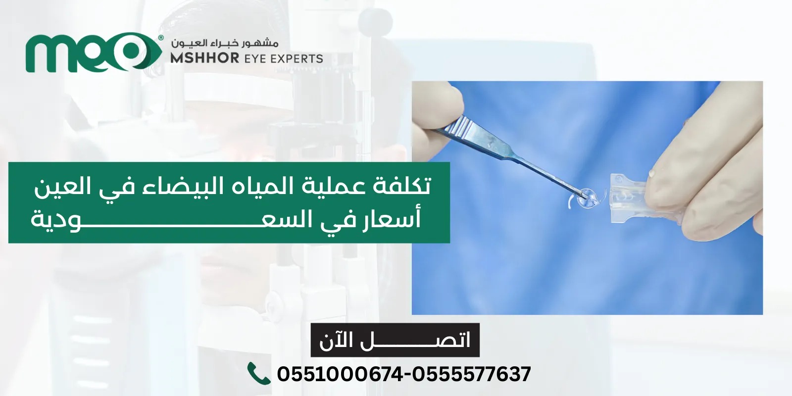 تكلفة عملية المياه البيضاء في العين