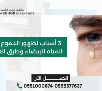 الدموع بعد عملية المياه البيضاء