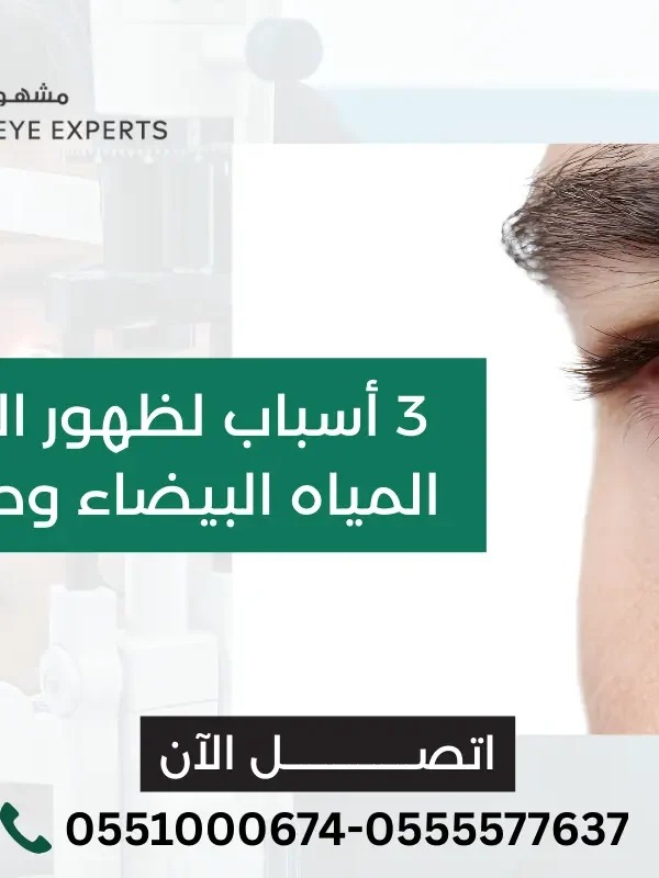 الدموع بعد عملية المياه البيضاء