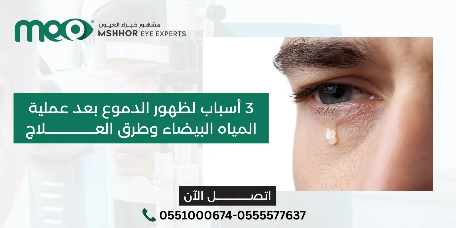 الدموع بعد عملية المياه البيضاء